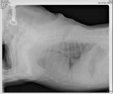 RTG + sono: Srdce, plíce, trachea